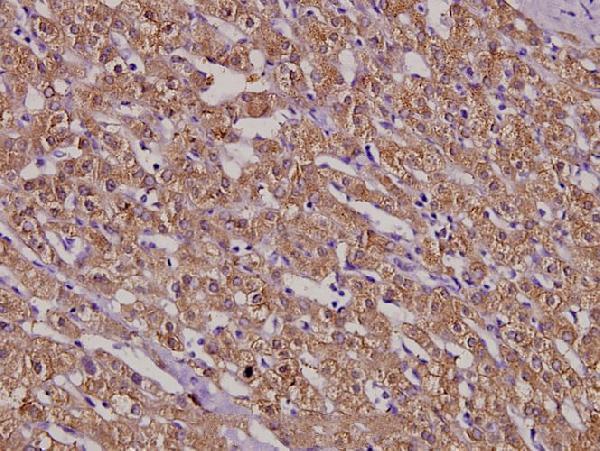 a02455 msh3 primary antiboties ihc testing 2