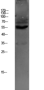 a02456 slc22a6 primary antibodies wb testing 1