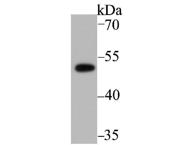a02457 1 pick1 primary antiboties wb testing 1