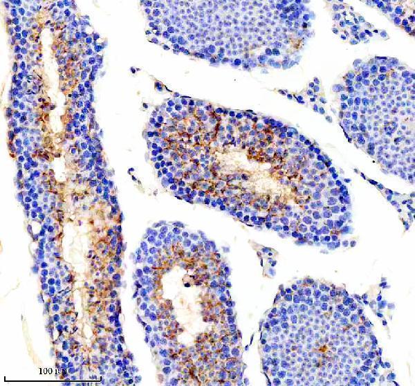  IHC analysis of PICK1 using anti-PICK1 antibody (A02457-2)
