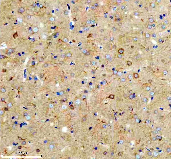  IHC analysis of PICK1 using anti-PICK1 antibody (A02457-2)