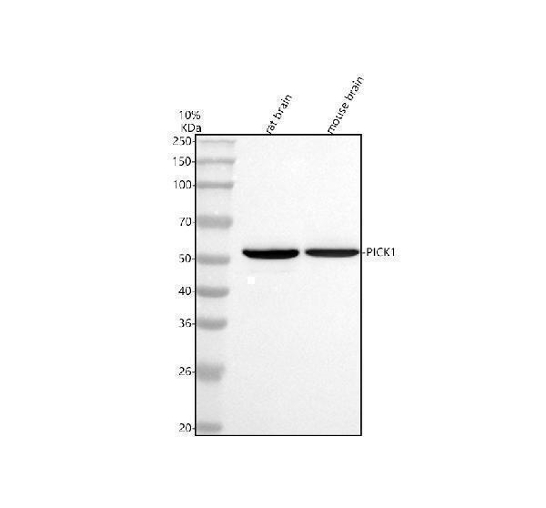  Western blot analysis of PICK1 using anti-PICK1 antibody (A02457-2)