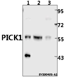 Western blot (WB) analysis of PICK1 pAb at 1:500 dilution
Lane1:SHSY5Y  whole cell lysate(40ug)
Lane2:U-87MG whole cell lysate(40ug)
Lane3:HEK293T whole cell lysate(40ug)