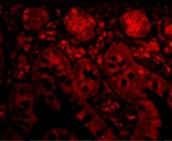 a02459 1 ptrh2 primary antibodies if testing 3
