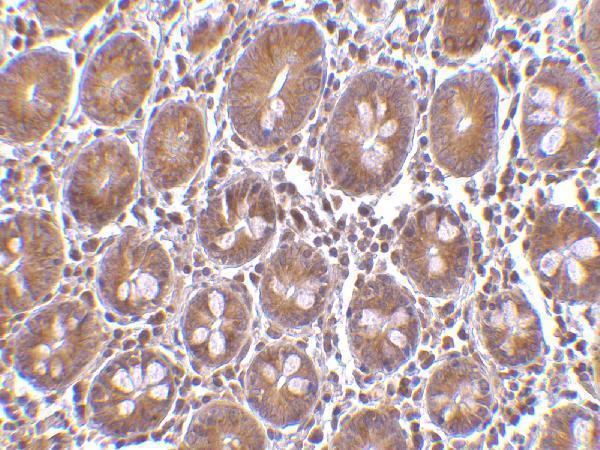 a02459 1 ptrh2 primary antibodies ihc testing 2