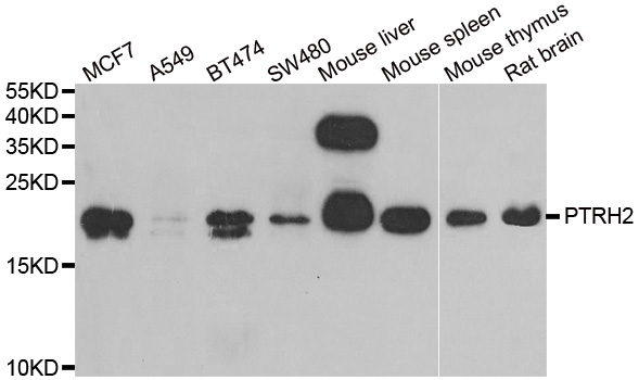 a02459 2 ptrh2 primary antiboties wb testing 1