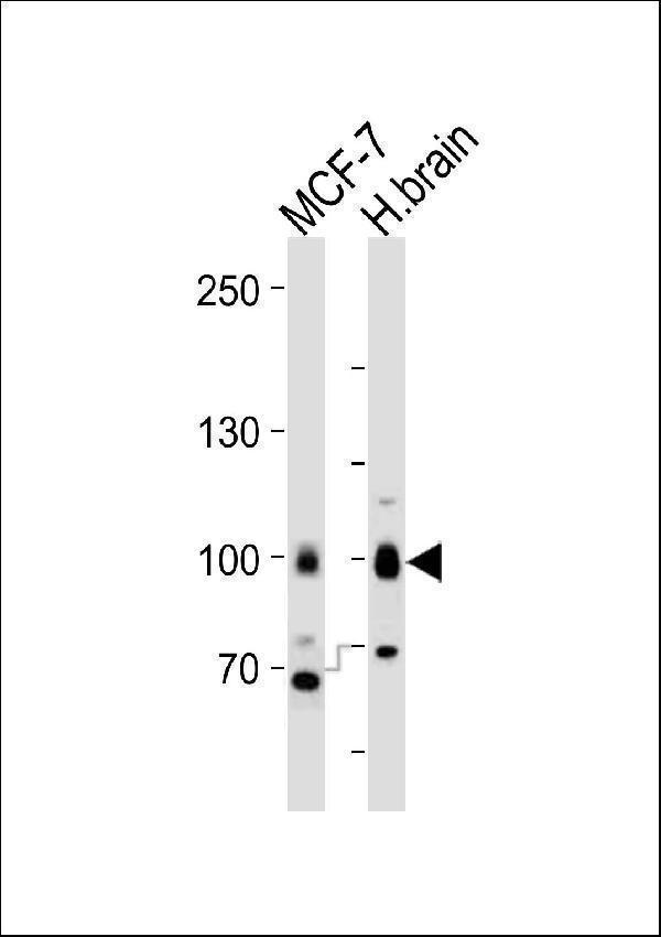 Western blot analysis of lysates from MCF-7, H