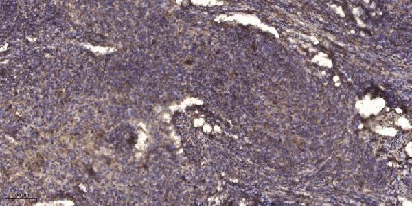 a02460 tle1 primary antibodies ihc testing 1