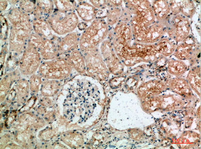 a02460 tle1 primary antibodies ihc testing 3