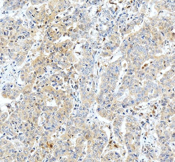 a02461 1 gsto1 primary antibodies ihc testing 2