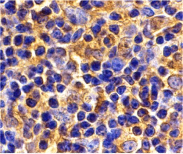 a02462 1 ube2n primary antibodies ihc testing 2