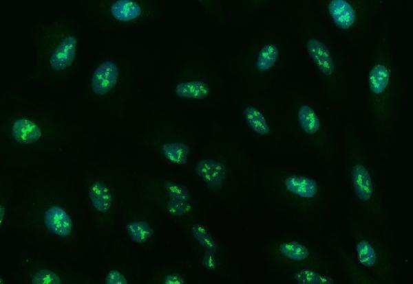 a02462 2 ube2n primary antibodies if testing 6