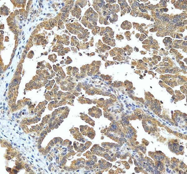 a02462 2 ube2n primary antibodies ihc testing 1
