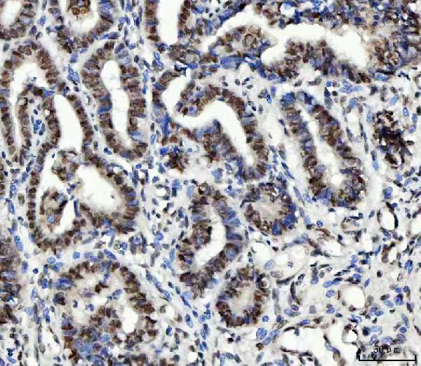 a02462 2 ube2n primary antibodies ihc testing 2