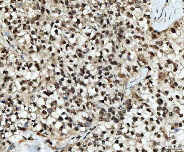 a02462 2 ube2n primary antibodies ihc testing 3