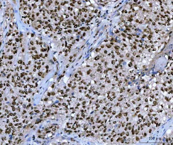a02462 2 ube2n primary antibodies ihc testing 4