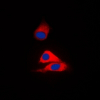 Immunofluorescence analysis of HepG2 cells using MVK pAb at dilution of 1:50
