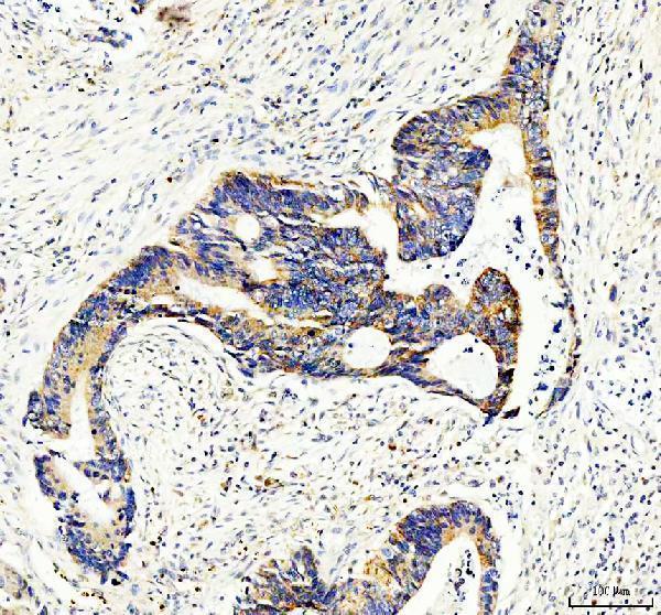 IHC analysis of MVK using anti-MVK antibody (A02465-2)
