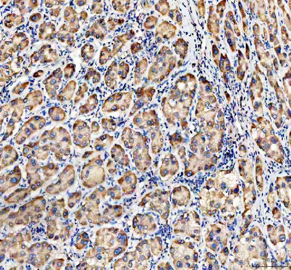 IHC analysis of MVK using anti-MVK antibody (A02465-2)