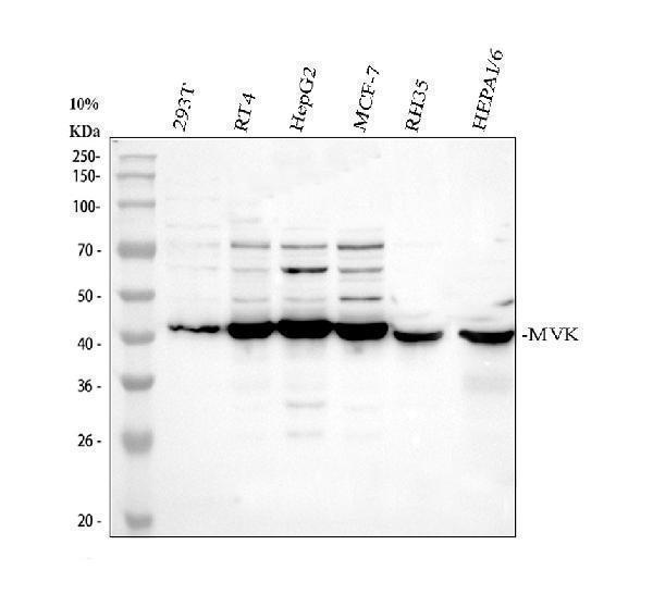 Western blot analysis of MVK using anti-MVK antibody (A02465-2)