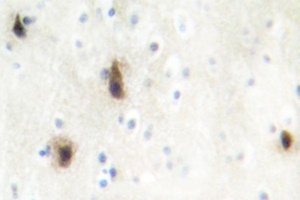 Immunohistochemistry (IHC) analyzes of MVK (N175) pAb in paraffin-embedded human brain tissue