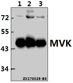 Western blot (WB) analysis of MVK (N175) pAb at 1:500 dilution
Lane1:PC3 whole cell lysate(20ug)
Lane2:HepG2 whole cell lysate(40ug)
Lane3:MCF-7 whole cell lysate(40ug)