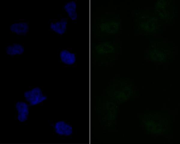 ICC staining Lipin 1 in HUVEC cells (green)