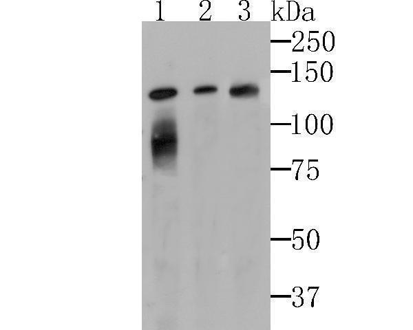 Western blot analysis of Lipin 1 on different cell lysates using anti-Lipin 1 at 1/500 dilution
