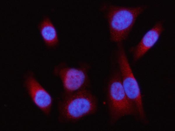  IF analysis of Lipin 1/LPIN1 using anti-Lipin 1/LPIN1 antibody (A02467-2)