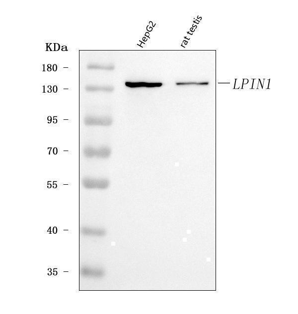  Western blot analysis of Lipin 1/LPIN1 using anti-Lipin 1/LPIN1 antibody (A02467-2)
