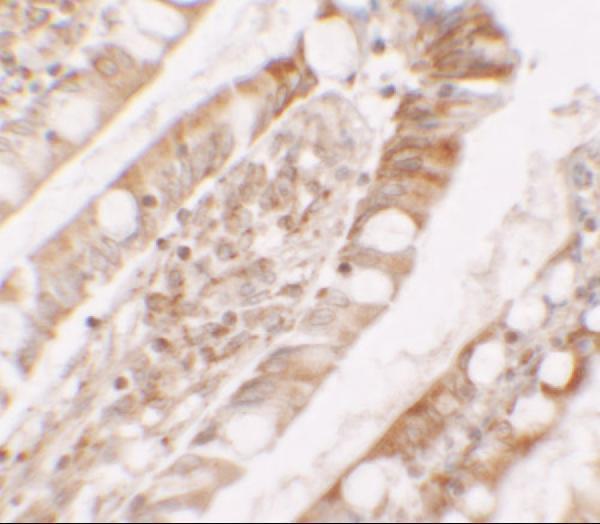 a02467 lpin1 primary antibodies ihc testing 2