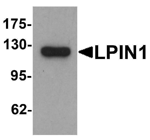 a02467 lpin1 primary antibodies wb testing 1