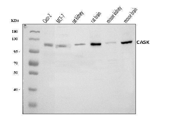  Western blot analysis of CASK using anti-CASK antibody (A02468-2)
