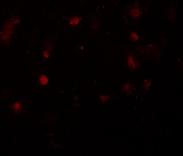 a02468 cask primary antibodies if testing 2