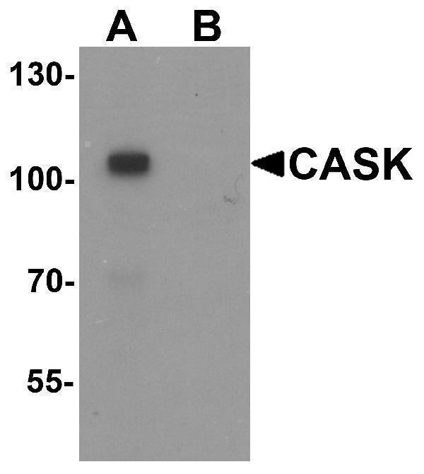 a02468 cask primary antibodies wb testing 1