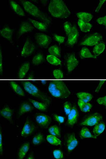 Immunofluorescence analysis of HepG2 cells using KIR2DL3 antibody 