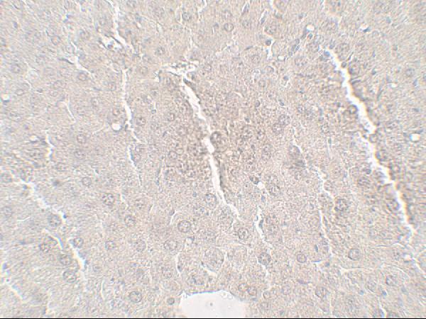 a02471 1 c19orf80 primary antibodies ihc testing 2