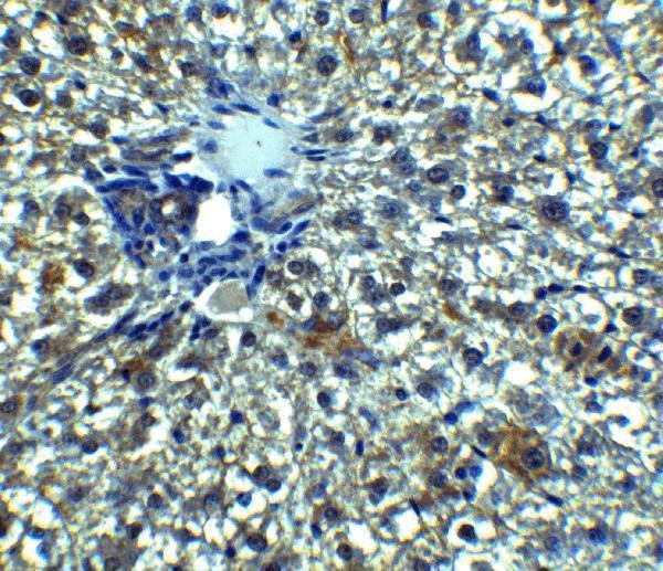 a02471 1 c19orf80 primary antibodies ihc testing 3