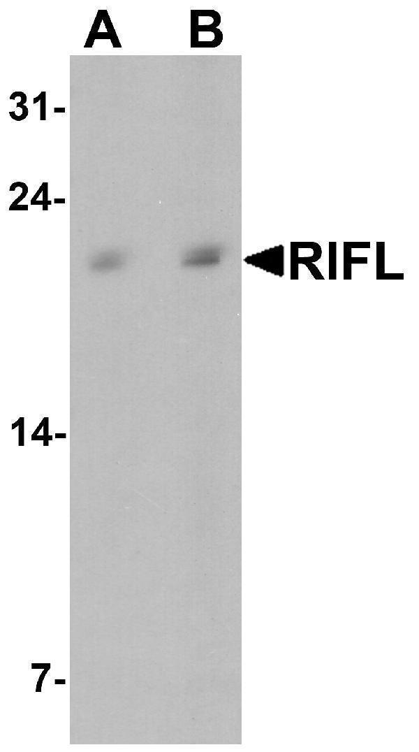 a02471 1 c19orf80 primary antibodies wb testing 1