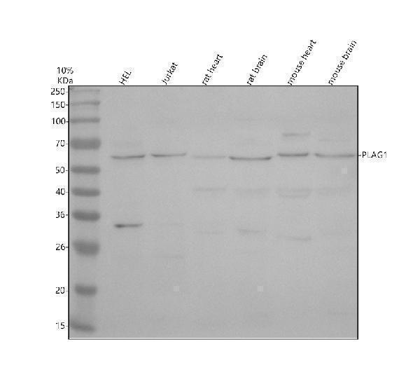 Western blot analysis of PLAG1 using anti-PLAG1 antibody (A02472-1)