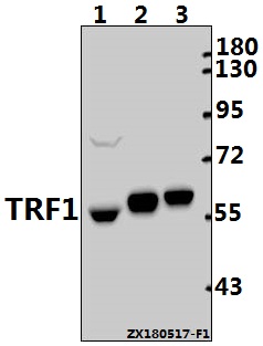 Western blot (WB) analysis of TRF1 (L215) pAb at 1:1000 dilution
Lane1:The Ovary tissue lysate of Rat(40ug)
Lane2:The Testis tissue lysate of Mouse(10ug)
Lane3:A2780 whole cell lysate(10ug)