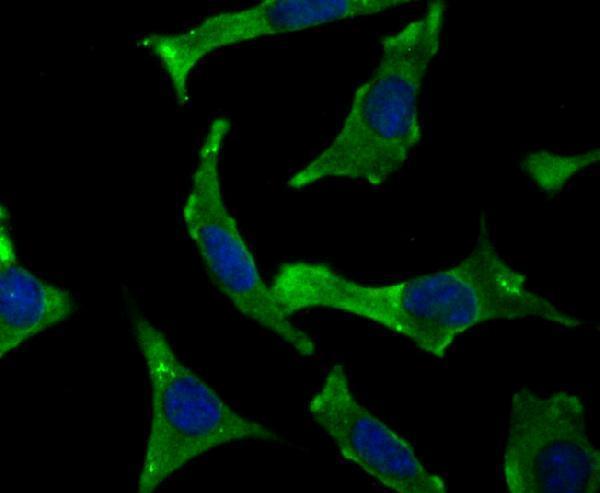 ICC staining Syntenin in SH-SY-5Y cells (green)