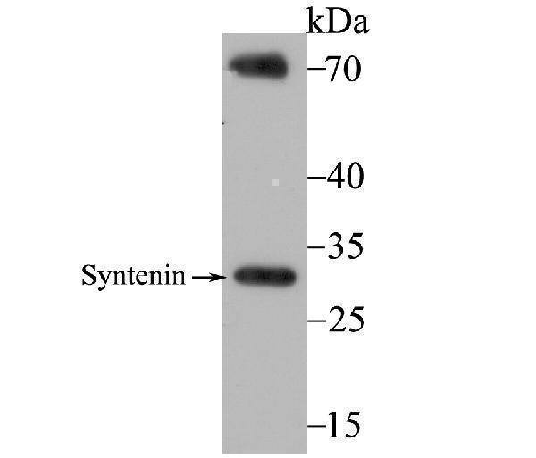 Western blot analysis of Syntenin on A549 cell using anti-Syntenin antibody at 1/2,000 dilution