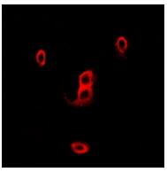 a02476 ncf2 primary antiboties if testing 3