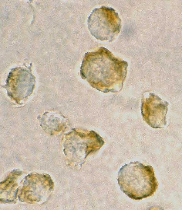 Immunocytochemistry of Nudel in Jurkat cells with Nudel antibody at 2 μg/mL