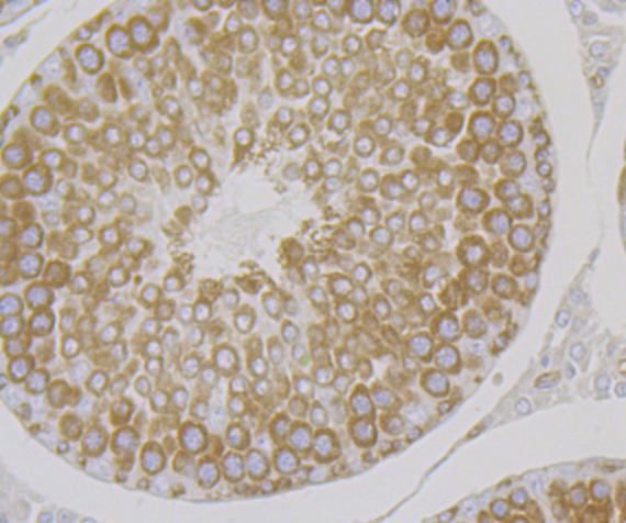 a02479 2 kars primary antiboties ihc testing 2