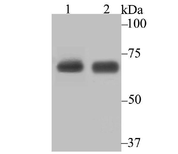 a02479 2 kars primary antiboties wb testing 1