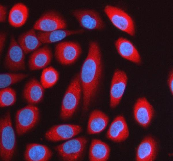 a02479 3 kars1 primary antibodies if testing 1