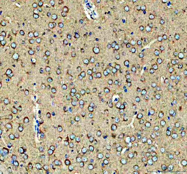 IHC analysis of KARS1 using anti-KARS1 antibody (A02479-3)