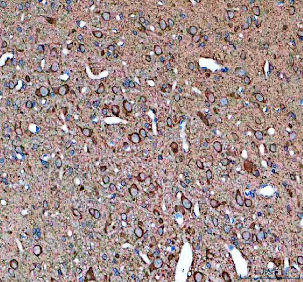 IHC analysis of KARS1 using anti-KARS1 antibody (A02479-3)